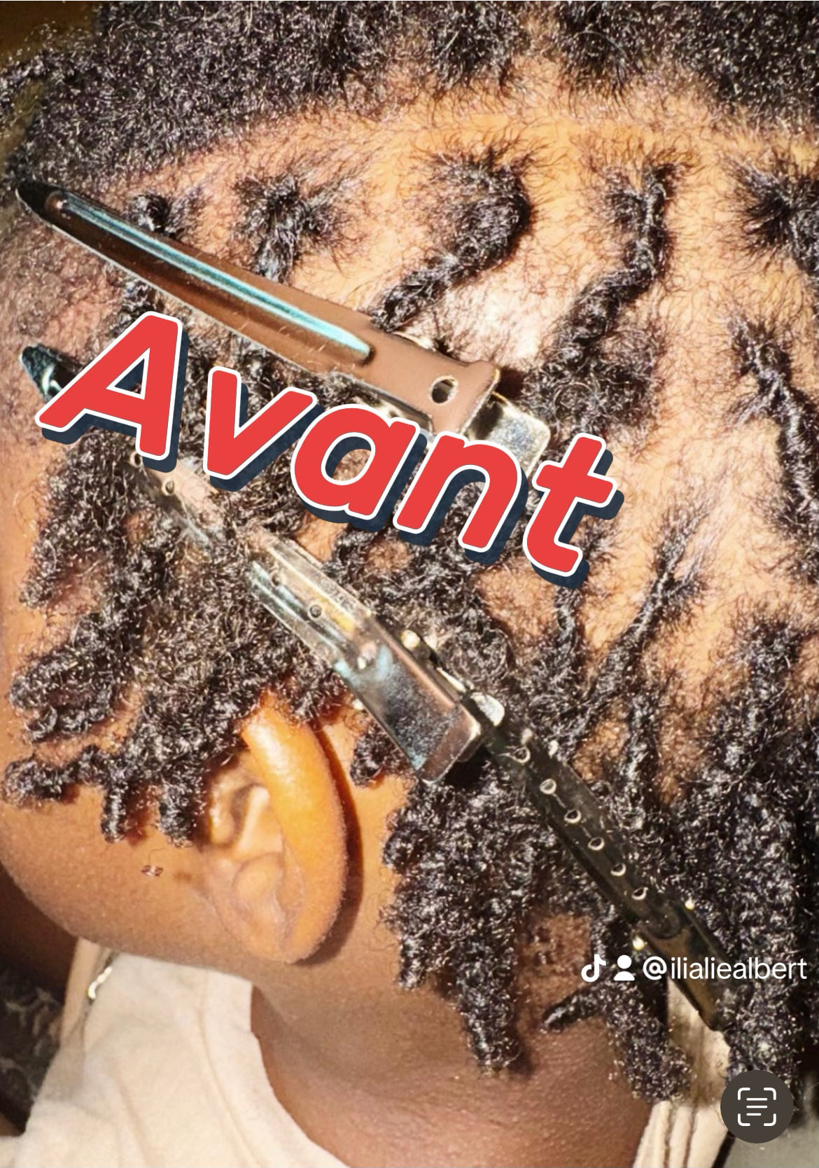 Huile de Pousse — Cheveux Crépus & Métissés | Onction Naturelle